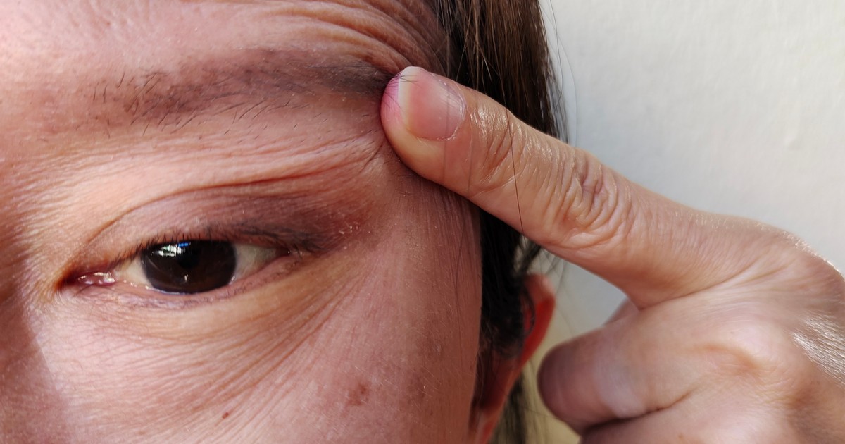 Ten problem dotyczy choćby miliona Polaków. "Powoduje zmęczenie"