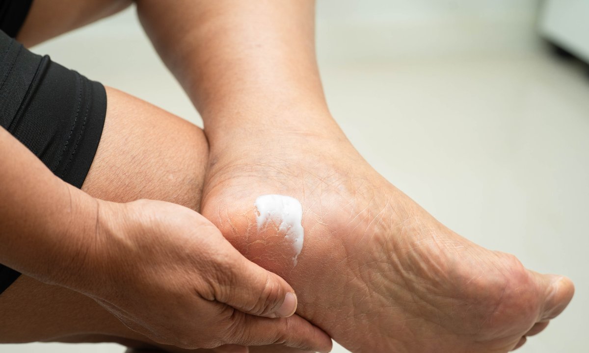 Ten krem za 6zł to ratunek dla suchych i zrogowaciałych pięt i stóp! Natychmiastowe nawilżenie