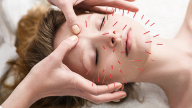 Czy akupunktura jest skuteczna? Wieloletni badacz wylicza wątpliwości