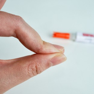 Így távolíthatja el a pillanatragasztót a bőréről