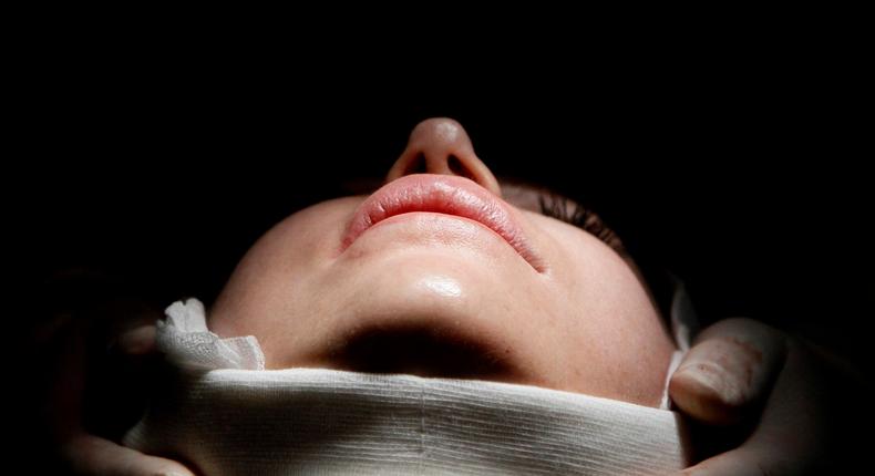 A woman undergoing a plastic surgery procedure.