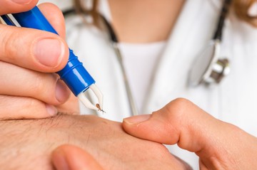 Lyme-kór fertőzés: ezekkel a betegségekkel keverhetők össze a tünetei