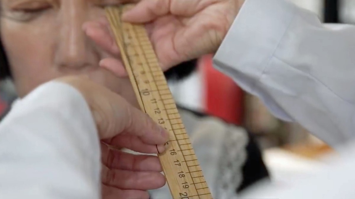 Ženi (58) trepavice porasle preko 20 centimetara: Lekari bez teksta gledali u nalaze