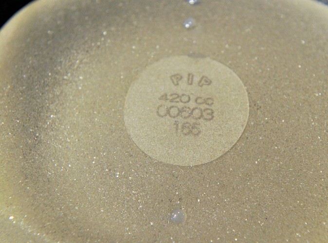 We Francji z silikonowych implantów piersi PIP korzysta około 30 tysięcy kobiet, a na świecie 400-500 tys. kobiet.