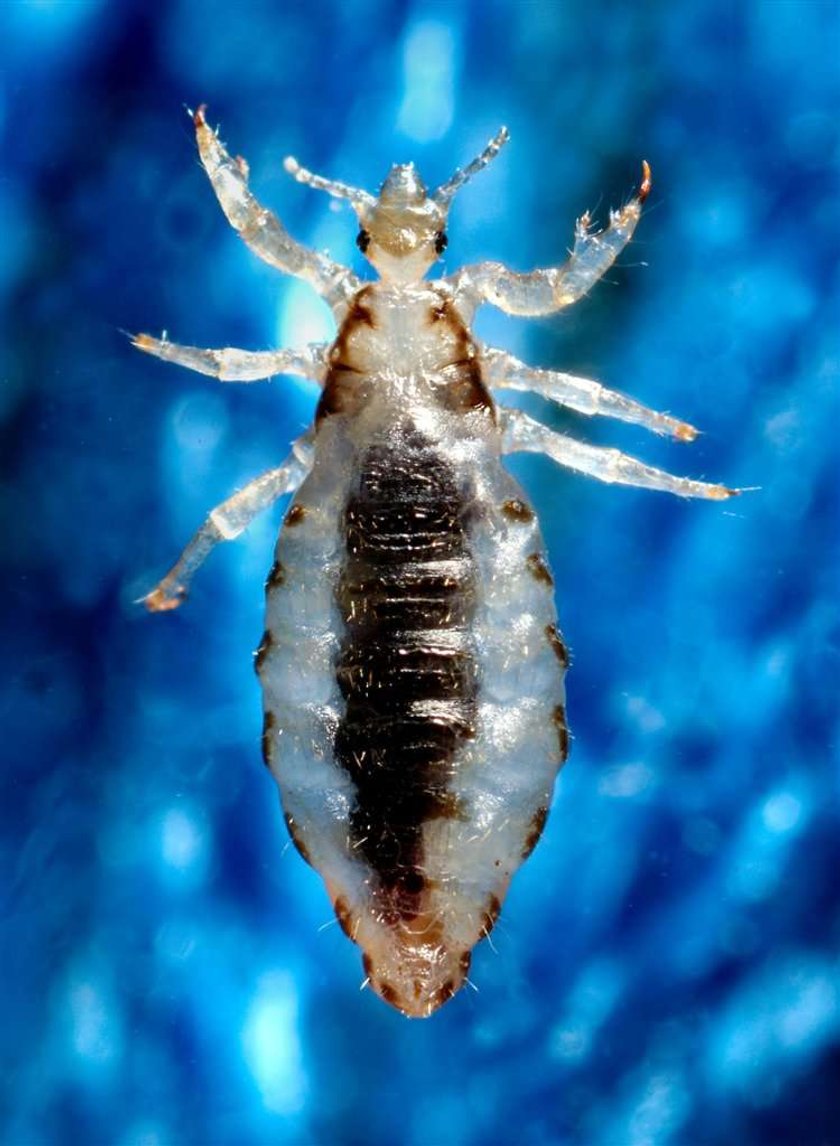 Pediculus humanus, wesz ludzka