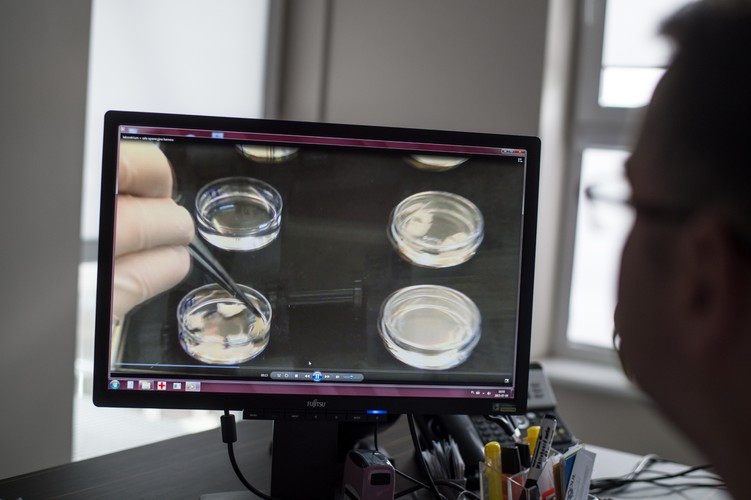 Pierwszy w Polsce zabieg wszczepienia tkanek jajnika