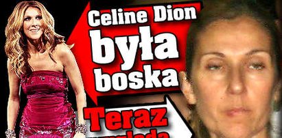 Celine Dion była boska. Teraz wygląda strasznie