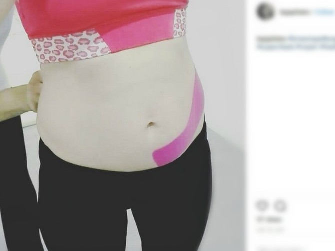 Kinezi trake su vrlo delotvorne