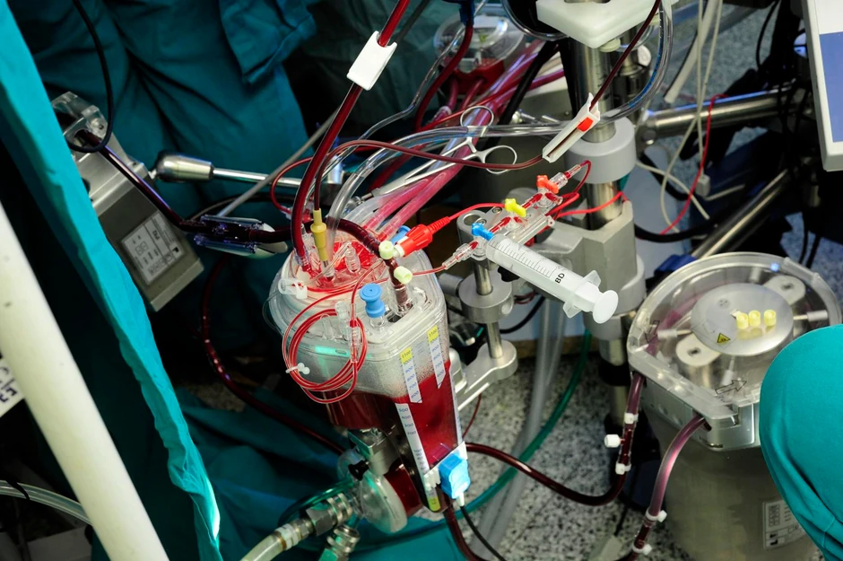 Mašina za veštački krvotok, obavlja sve funkcije umesto pacijenta