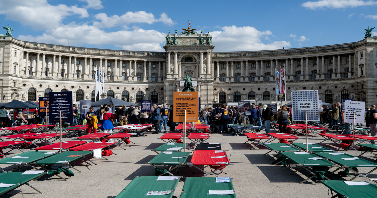 GP warns chronic fatigue signs often mistaken for burnout