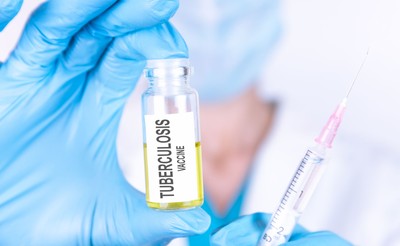 A jednak! Szczepienie przeciw gruźlicy nie chroni przed COVID-19. Wyniki badań