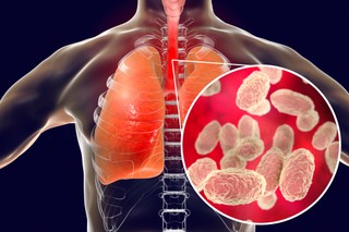 Bezpłatne szczepionki na krztusiec dla kobiet w ciąży. Jak skorzystać?
