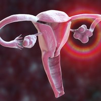 Gyakori betegség a nőiesség útjában: a PCOS-szindróma minden tizedik nőt érinti