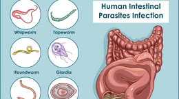 Choroby pasożytnicze - owsica, świerzb, wszawica