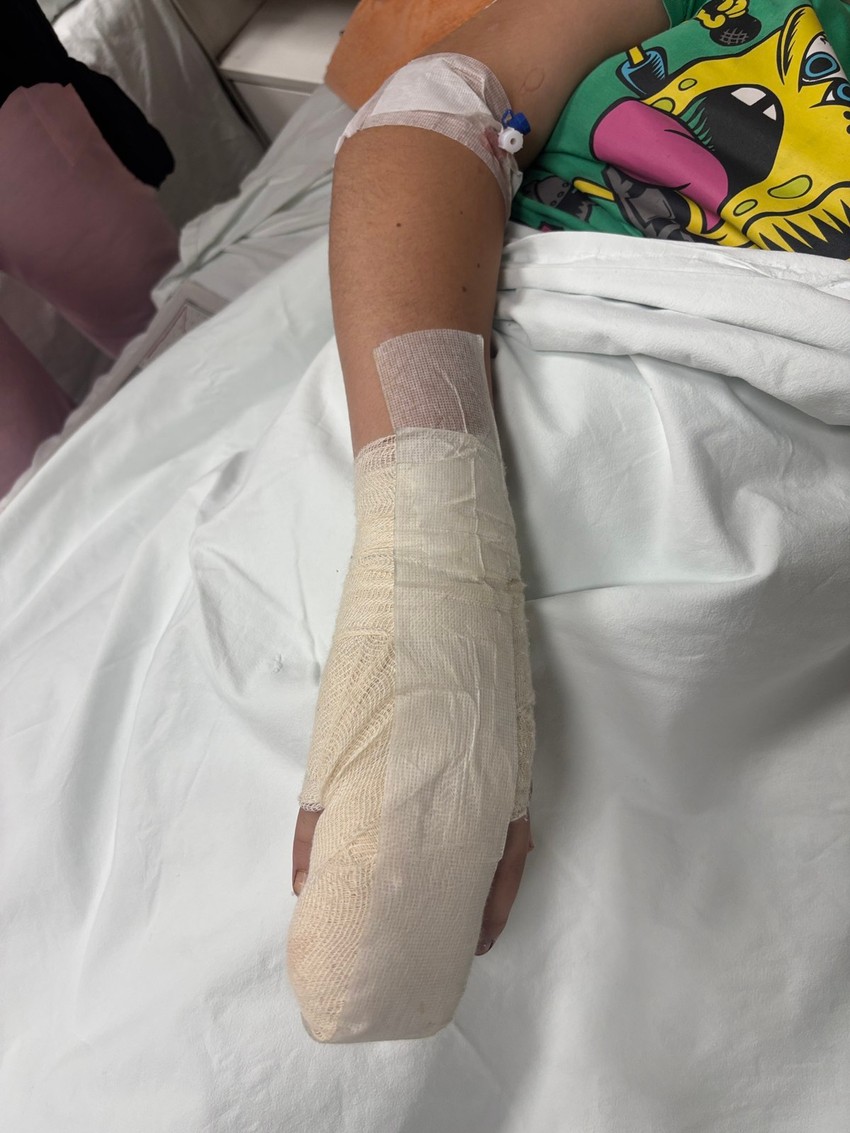 Dečaku iz Niša amputiran deo prsta