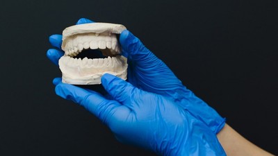 A person with latex gloves holding a dental cast [Photo: Polina Zimmerman]