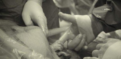 Wzruszające zdjęcie z porodu. Z brzucha wyszła rączka i...
