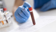  Testy genetyczne – jakie nowotwory można przewidzieć? 