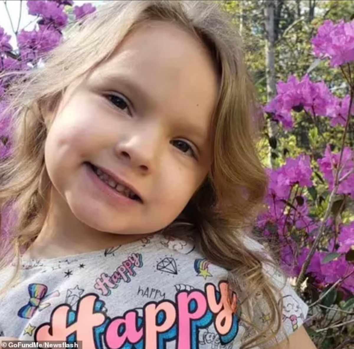 Devojčica (6) se možda više NIKAD NEĆE OSMEHNUTI nakon što ju je pitbul ...