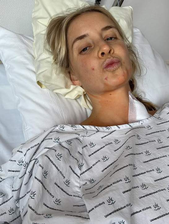 Kim chorobu spočiatku úspešne potlačila.