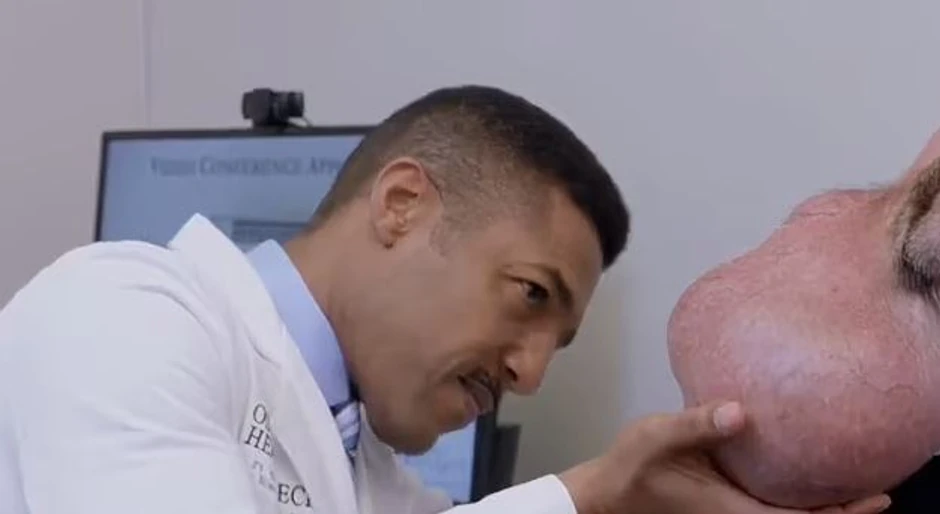 Tumor koji je Tim imao godinama na licu