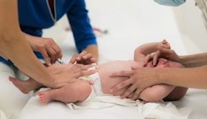 Bebe primaju hepatitis B na rođenju