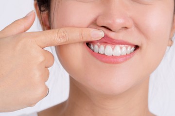 Ha ilyen színű az ínye, súlyos figyelmeztető jel lehet