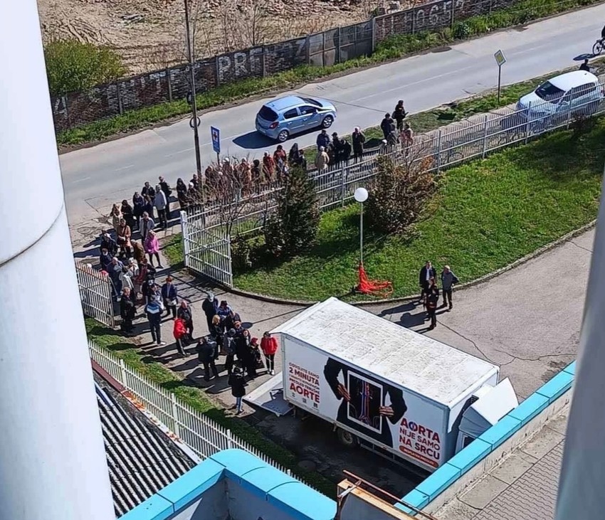 Pregledi stomačne aorte