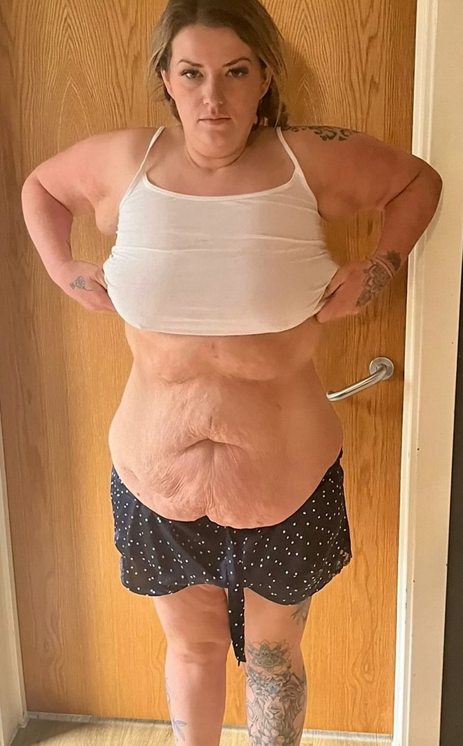 Sara pre operacije