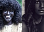 Why people living near the Equator have darker skin