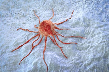 tumor_0