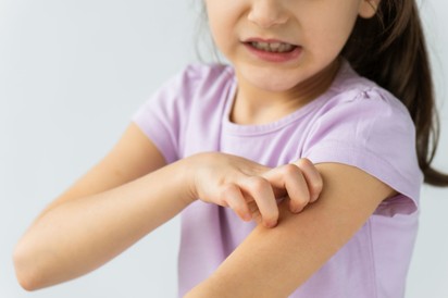 Atópiás dermatitisz: már enyhe tünetek esetén is forduljon szakemberhez!