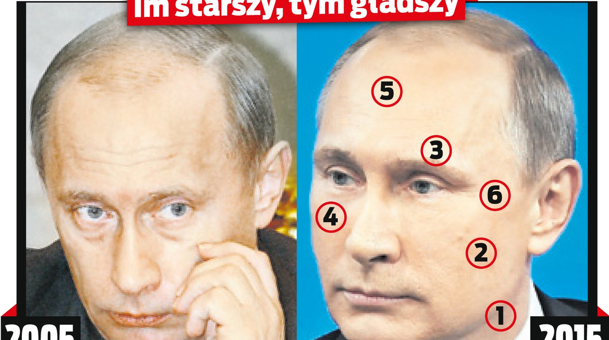Путин пластика носа