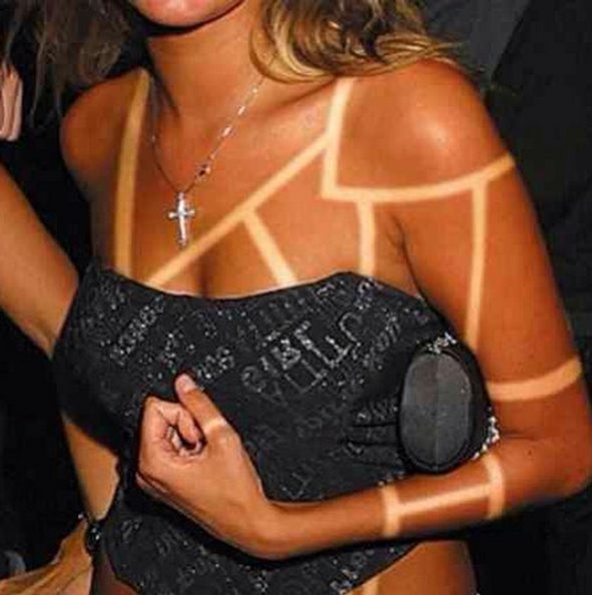 Sunburn Art