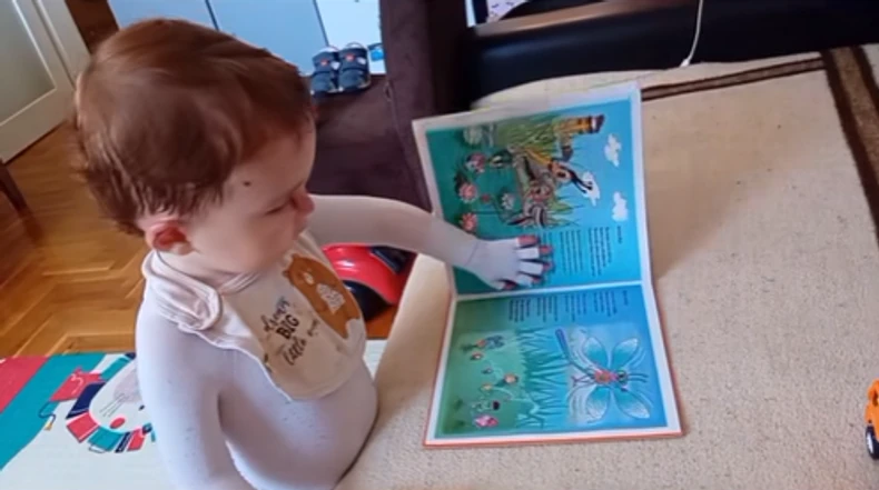 "Nažalost, u Srbiji se iz raznoraznih razloga zna o epidermolizi, i samo 40 ljudi ima ovu dijagnozi"