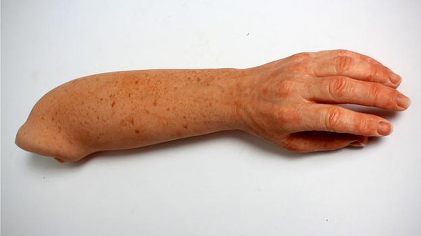 Nadrealno: Za one koji to žele, veštački udovi se proizvode i sa pegama i naborima