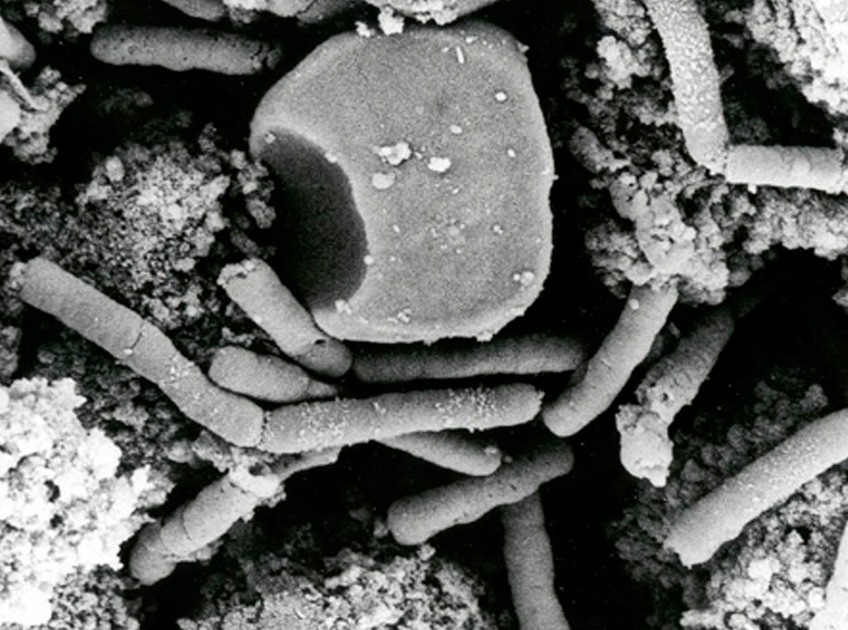 Nowa superbakteria jest już w Europie