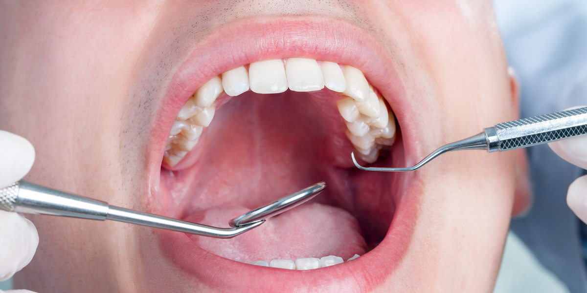 COVID i choroby zębów. Czy mają związek ze sobą? Im zęby i dziąsła są w lepszym stanie, tym mniejsze masz ryzyko zachorowania na COVID — donoszą naukowcy. 
