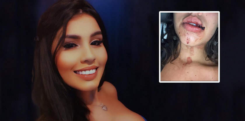 19-letnia celebrytka odurzona i brutalnie skrzywdzona przez grono influencerów. Chce sprawiedliwości