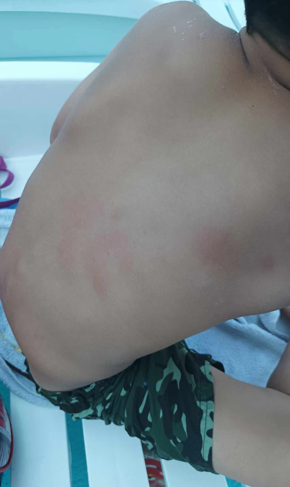 Nisu jedini čija su se deca povredila