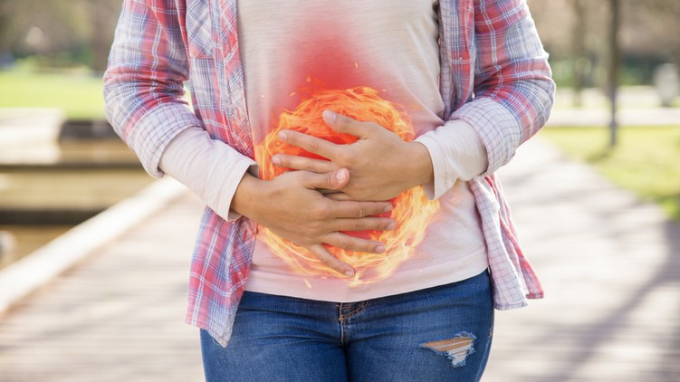 reflux, gyomorégés, gyomorsav, GERD, savas, gyomorfájás, krákogás, reflux betegség