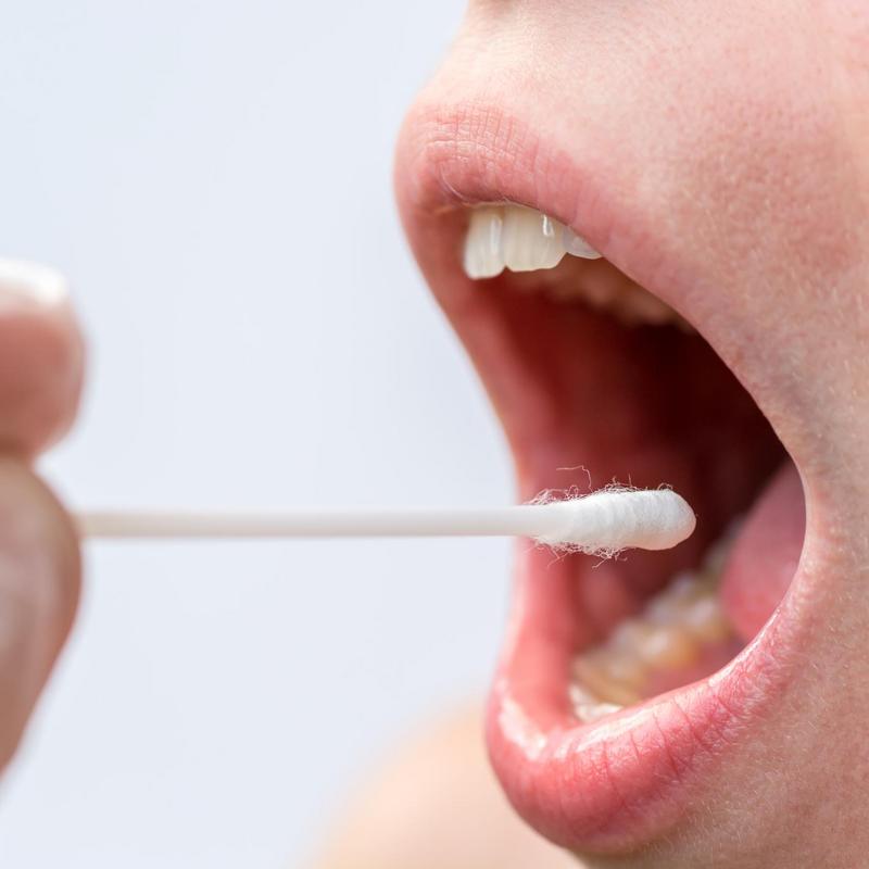 Nowotwory Jamy Ustnej Przyczyny Objawy I Leczenie