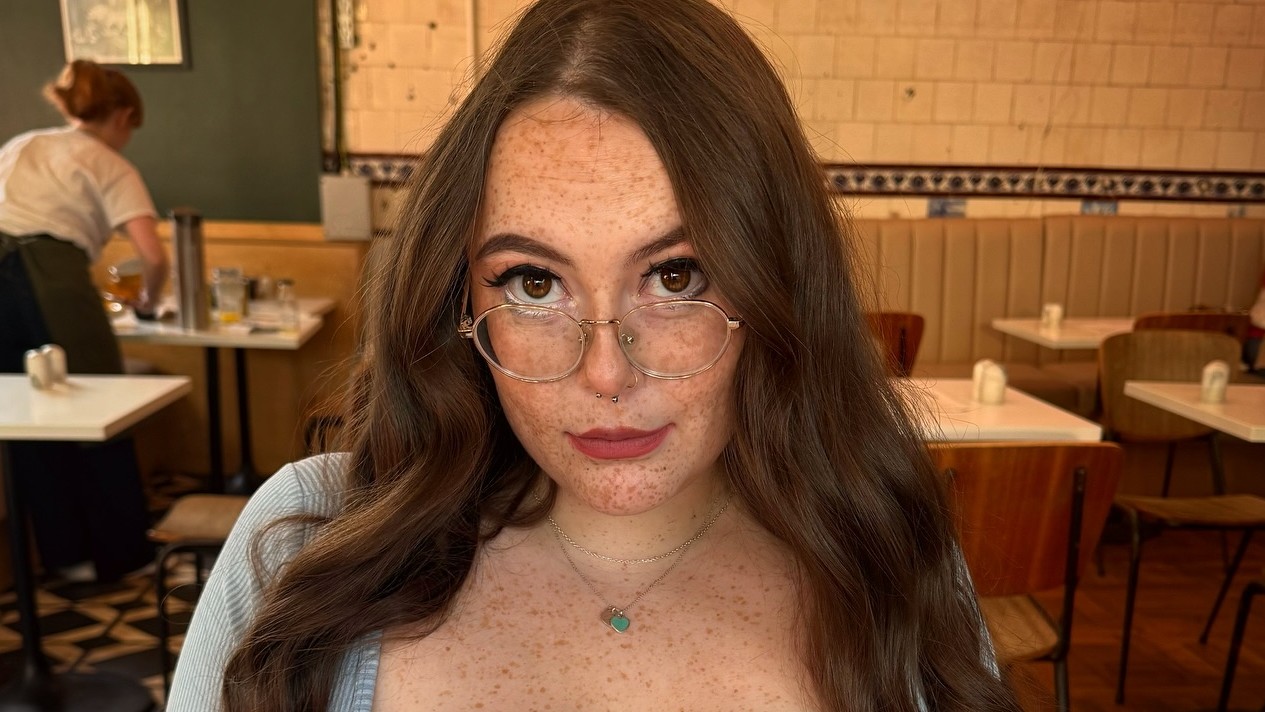 Summer Robertová trpí vzácnym ochorením, kvôli ktorému jej neustále rastú prsia. 