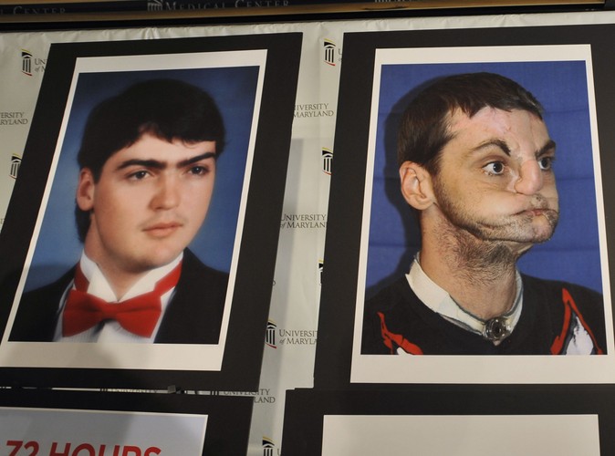 Richard Lee Norris dostał nową twarz