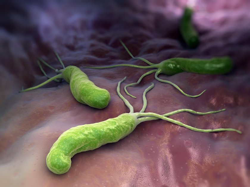 Za powstawanie wrzodów w ponad 90 proc. przypadków odpowiada bakteria Helicobacter pylori