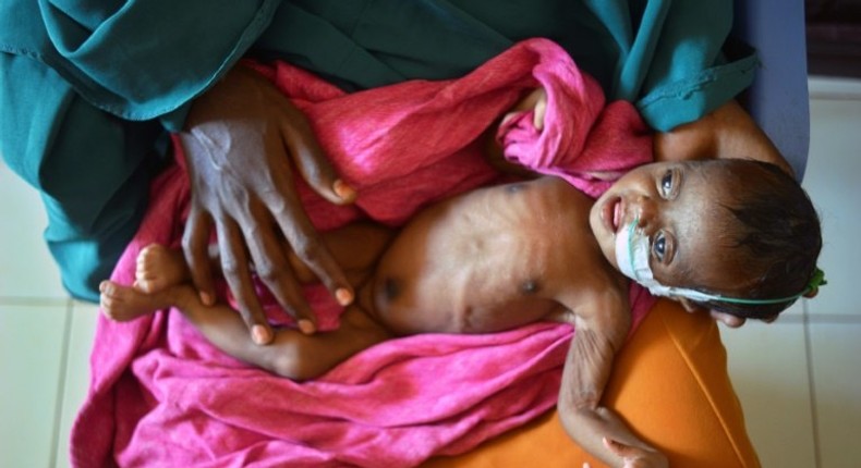 A severely malnourished child in the hands of her mother waits to be processed into a UNICEF- funded health programme catering to children displaced by drought, at the regional hospital in Baidoa town in south-western Somalia