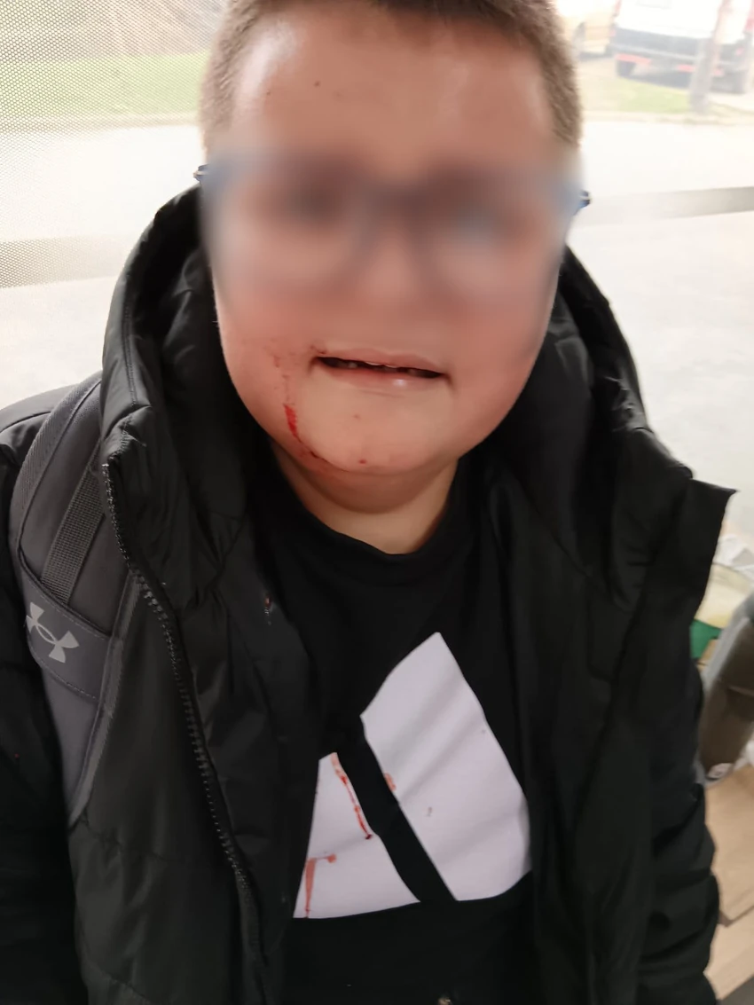 В.С., ученик од Власотицин, врсничко насилство