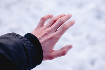 Vörös és viszket? Innen tudhatja, hogy téli bőrszárazság, vagy ekcéma az oka