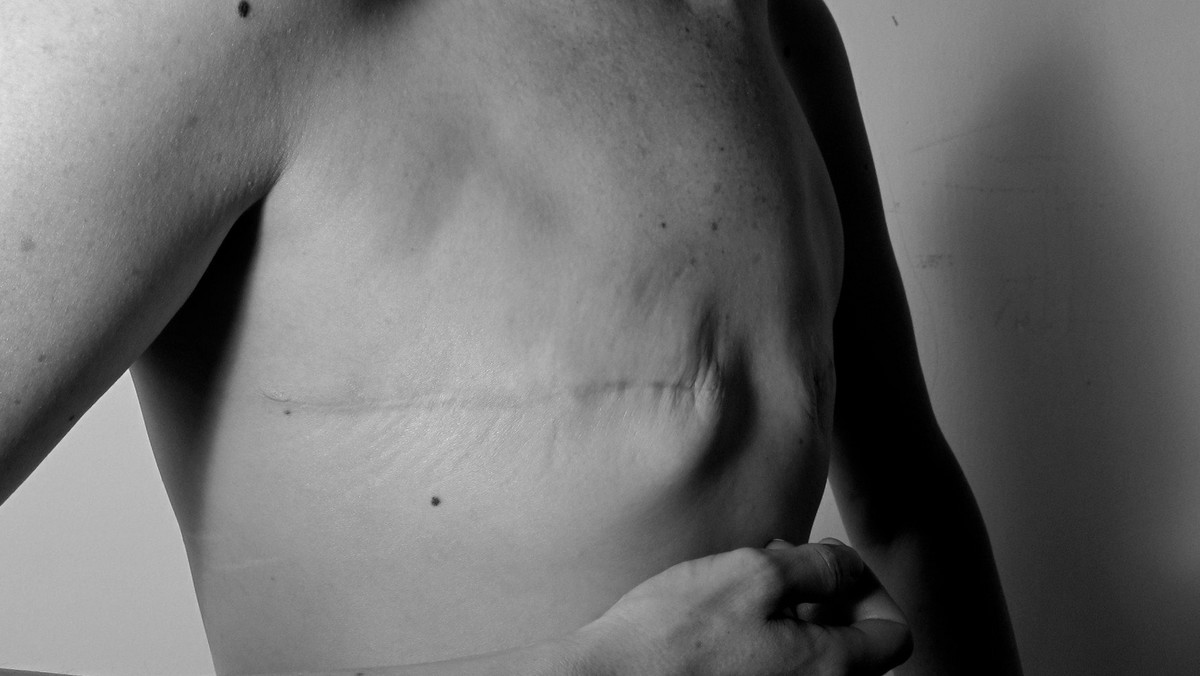Niezwykła seria tych zdjęć powstała, żeby udowodnić kobietom, że mimo zabiegu amputacji piersi, ich ciała wciąż są piękne. Niektóre ujęcia są naprawdę szokujące i piękne.
