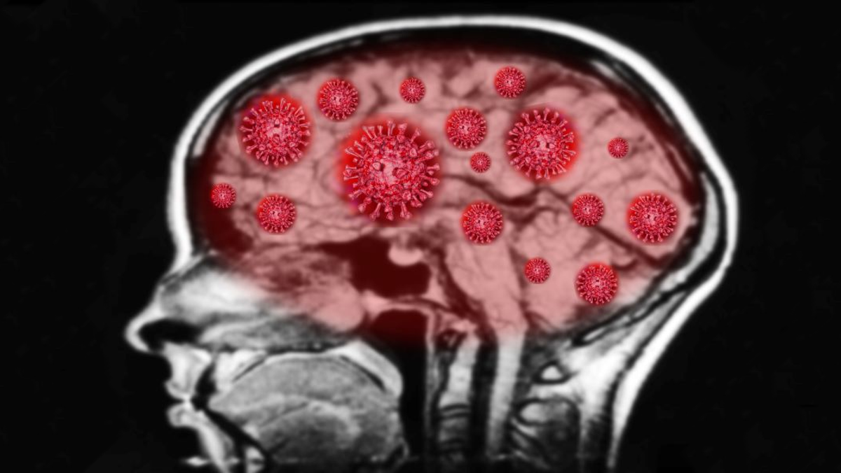COVID-19 uszkadza układ nerwowy